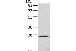 Western Blot analysis of 293T cell using CLEC4D Polyclonal Antibody at dilution of 1:123 (CLEC4D Antikörper)