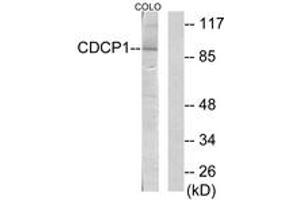 Western blot analysis of extracts from COLO205 cells, using CDCP1 Antibody. (CDCP1 Antikörper  (AA 691-740))