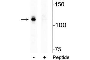 Western Blotting (WB) image for anti-Androgen Receptor (AR) (pSer94) antibody (ABIN6254125)