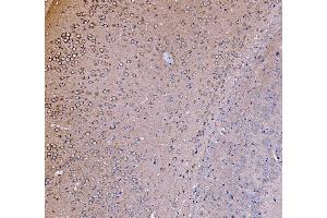 IHC analysis of PI 3 Kinase p85 alpha/PIK3R1 using anti-PI 3 Kinase p85 alpha/PIK3R1 antibody (ABIN7599781). (PIK3R1 Antikörper  (AA 117-153))