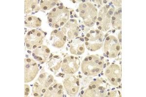 Immunohistochemistry of paraffin-embedded Human gastric using POU2F1 antibody at dilution of 1:100 (x400 lens).