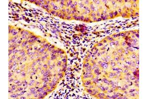Immunohistochemistry (IHC) image for anti-Nuclear Factor of kappa Light Polypeptide Gene Enhancer in B-Cells 1 (NFKB1) (AA 1-961) antibody (ABIN7161781)