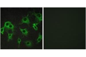 Immunofluorescence analysis of COS7 cells, using ADRB2 Antibody. (beta 2 Adrenergic Receptor Antikörper  (AA 336-385))