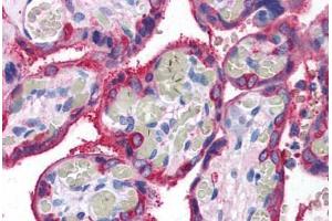 Human Placenta (formalin-fixed, paraffin-embedded) stained with TGM2 antibody ABIN307194 at 5 ug/ml followed by biotinylated goat anti-rabbit IgG secondary antibody ABIN481713, alkaline phosphatase-streptavidin and chromogen. (Transglutaminase 2 Antikörper)
