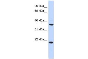 TMEM74 antibody used at 1 ug/ml to detect target protein.