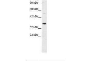 Image no. 2 for anti-General Transcription Factor IIH, Polypeptide 3, 34kD (GTF2H3) (AA 59-108) antibody (ABIN6735772) (GTF2H3 Antikörper  (AA 59-108))