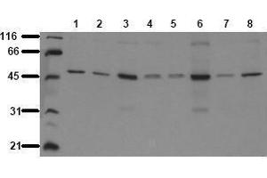 Western Blotting (WB) image for anti-Glycogen Synthase Kinase 3 alpha (GSK3a) antibody (ABIN126803) (GSK3 alpha Antikörper)