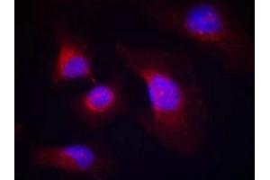 Immunofluorescence staining of methanol-fixed Hela cells using syk(phospho-Tyr323) Antibody.