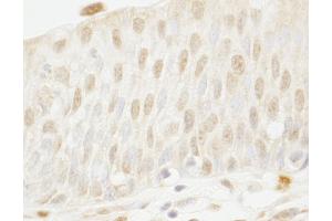 Immunohistochemistry (IHC) image for anti-Myb-Binding Protein 1A (MYBBP1A) (AA 450-500) antibody (ABIN7448678) (MYBBP1A Antikörper  (AA 450-500))