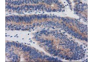 Immunohistochemistry (IHC) image for anti-Bridging Integrator 3 (BIN3) antibody (ABIN1496922) (BIN3 Antikörper)