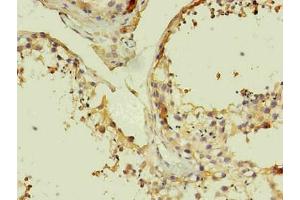 Immunohistochemistry of paraffin-embedded human testis using ABIN7140933 in 30 μg/mL dilute concentrations. (CD14 Antikörper)
