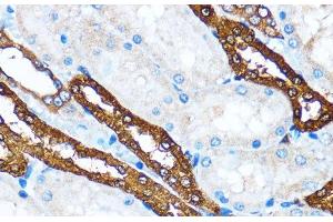 Immunohistochemistry of paraffin-embedded Rat kidney using PIK3CA Polyclonal Antibody at dilution of 1:100 (40x lens). (PIK3CA Antikörper)