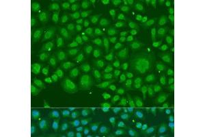 Immunofluorescence analysis of U2OS cells using HNRNPR Polyclonal Antibody at dilution of 1:100. (HNRNPR Antikörper)