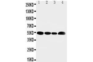 Anti-SLC16A4 antibody, Western blotting Lane 1: Rat Testis Tissue Lysate Lane 2: JURKAT Cell Lysate Lane 3: HELA Cell Lysate Lane 4: MCF-7 Cell Lysate (SLC16A4 Antikörper  (N-Term))