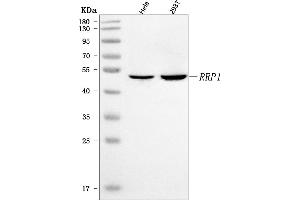Western blot analysis of RRP1 using anti-RRP1 antibody (ABIN7600683).