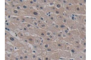 Immunohistochemistry (IHC) image for anti-Cadherin EGF LAG Seven Pass G-Type Receptor 3 (CELSR3) (AA 1181-1421) antibody (ABIN7443452)