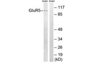 Western blot analysis of extracts from mouse brain cells, using GluR5 Antibody. (GRIK1 Antikörper  (AA 10-59))
