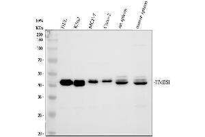 Western blot analysis of HMBS using anti-HMBS antibody (ABIN5692868).