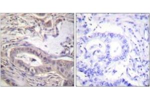 Immunohistochemistry (IHC) image for anti-BCL2-Like 1 (BCL2L1) (AA 13-62), (pThr47) antibody (ABIN1531492)