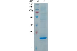 SDS-PAGE (SDS) image for Fibroblast Growth Factor 19 (FGF19) (AA 25-216) protein (His tag) (ABIN7491497)