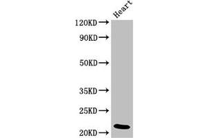 Western Blot Positive WB detected in: Rat heart tissue All lanes: NDUFB9 antibody at 4 μg/mL Secondary Goat polyclonal to rabbit IgG at 1/50000 dilution Predicted band size: 22 kDa Observed band size: 22 kDa (NDUFB9 Antikörper  (AA 50-179))