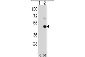 Western blot analysis of GEA9 (arrow) using rabbit polyclonal GEA9 Antibody  (ABIN390111 and ABIN2840622). (MAGEA9 Antikörper  (AA 171-198))