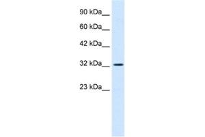Western Blotting (WB) image for anti-SWI/SNF Related, Matrix Associated, Actin Dependent Regulator of Chromatin, Subfamily A, Member 2 (SMARCA2) antibody (ABIN2460965) (SMARCA2 Antikörper)