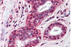 Human Breast (formalin-fixed, paraffin-embedded) stained with TLR4 antibody ABIN298531 at 5 ug/ml followed by biotinylated anti-mouse IgG secondary antibody ABIN481714, alkaline phosphatase-streptavidin and chromogen. (TLR4 Antikörper  (AA 100-200))