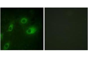 Immunofluorescence analysis of HeLa cells, using Keratin 18 (Phospho-Ser52) Antibody. (Cytokeratin 18 Antikörper  (pSer52))