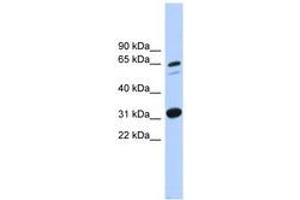 Image no. 1 for anti-Integrin alpha FG-GAP Repeat Containing 3 (ITFG3) (AA 431-480) antibody (ABIN6744874) (ITFG3 Antikörper  (AA 431-480))