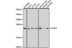Western blot analysis of extracts of various cell lines, using RAB2A antibody. (RAB2A Antikörper  (AA 1-212))