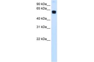 Western Blotting (WB) image for anti-Docking Protein 1, 62kDa (Downstream of tyrosine Kinase 1) (DOK1) antibody (ABIN2463701) (DOK1 Antikörper)