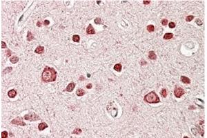 AP23695PU-N STK39 / SPAK Antibody staining of paraffin embedded Human Cerebral Cortex at 3. (STK39 Antikörper  (Internal Region))