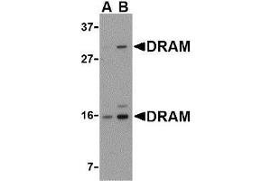 Western blot analysis of DRAM in 293 cell lysate with AP30304PU-N DRAM antibody at (A) 0. (DRAM Antikörper  (C-Term))