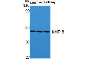Western Blot (WB) analysis of specific cells using KMT1B Polyclonal Antibody. (SUV39H2 Antikörper  (Internal Region))
