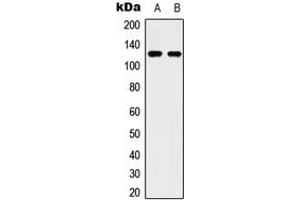 Western blot analysis of ULK2 expression in Hela (A), HepG2 (B) whole cell lysates. (ULK2 Antikörper  (C-Term))