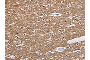 The image on the left is immunohistochemistry of paraffin-embedded Human brain tissue using ABIN7191592(NCR2 Antibody) at dilution 1/60, on the right is treated with synthetic peptide. (NKp44/NCR2 Antikörper)