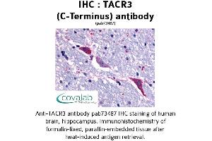 Image no. 1 for anti-Tachykinin Receptor 3 (TACR3) (C-Term), (Cytoplasmic Domain) antibody (ABIN1739880) (TACR3 Antikörper  (C-Term, Cytoplasmic Domain))