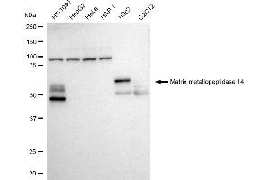 Western blotting analysis using Matrix metallopeptidase 14 antibody (ABIN7799340). (Rekombinanter MMP14 Antikörper)