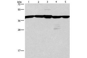 Western Blot analysis of A172 and 293T cell, Mouse kidney tissue, Human testis and brain malignant glioma tissue using GNA13 Polyclonal Antibody at dilution of 1:600 (GNA13 Antikörper)
