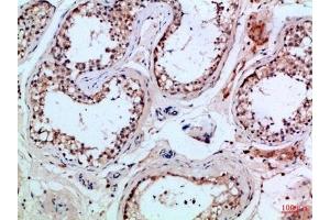 Immunohistochemical analysis of paraffin-embedded Human-testis, antibody was diluted at 1:100. (PIK3R2 Antikörper  (AA 1-60))