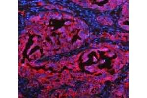 IF analysis of Cytokeratin 20/Krt20 using anti-Cytokeratin 20/Krt20 antibody (ABIN7601133). (KRT20 Antikörper  (AA 29-431))
