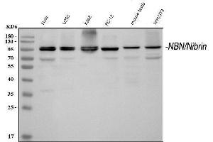 Western blot analysis of p95 NBS1 using anti-p95 NBS1 antibody (ABIN3043282). (Nibrin Antikörper  (C-Term))
