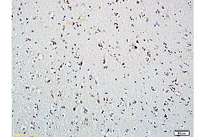 Formalin-fixed and paraffin embedded human brain labeled with Anti-HDAC2, Unconjugated (ABIN734813) followed by conjugation to the secondary antibody and DAB staining (HDAC2 Antikörper  (AA 391-488))