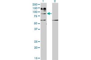 Western Blot analysis of IL31RA expression in transfected 293T cell line by IL31RA monoclonal antibody (M01), clone 3A10. (IL31RA Antikörper  (AA 21-120))