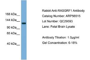 WB Suggested Anti-RASGRF1  Antibody Titration: 0. (RASGRF1 Antikörper  (Middle Region))