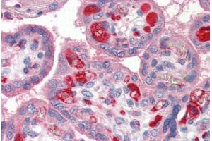 Human Placenta (formalin-fixed, paraffin-embedded) stained with PLTP antibody ABIN337143 at 1:100 followed by biotinylated goat anti-rabbit IgG secondary antibody ABIN481713, alkaline phosphatase-streptavidin and chromogen. (PLTP Antikörper)