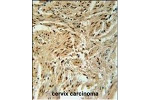 Immunohistochemistry (Paraffin-embedded Sections) (IHC (p)) image for anti-Biogenesis of Lysosomal Organelles Complex-1, Subunit 2 (BLOC1S2) (AA 14-40) antibody (ABIN651729)