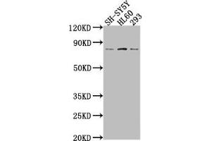 Western Blot Positive WB detected in: SH-SY5Y whole cell lysate, HL60 whole cell lysate, 293 whole cell lysate All lanes: CEACAM5 antibody at 1:2000 Secondary Goat polyclonal to rabbit IgG at 1/50000 dilution Predicted band size: 77 kDa Observed band size: 77 kDa (CEACAM5 Antikörper  (AA 1-255))