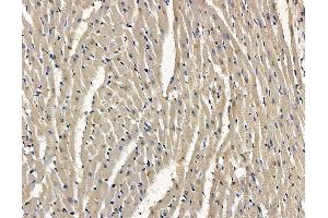 ABIN7096895 and ABIN7100961 at 1/100 staining rat heart tissue by IHC-P. (MPV17L2 Antikörper)